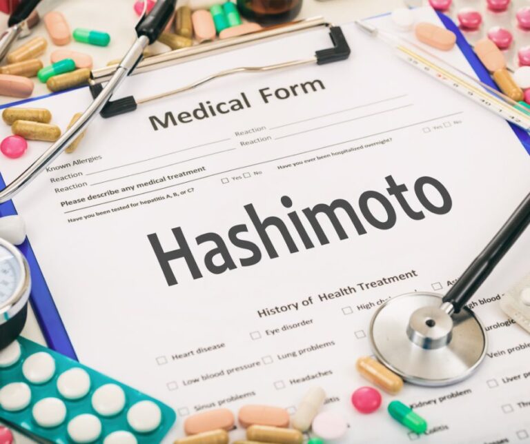 hashimoto a dieta