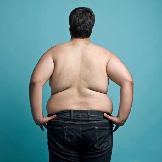 otyłość brzuszna